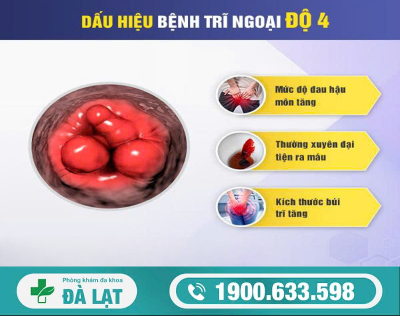 Hình ảnh minh họa